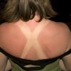 Kate enjoyed the warm weather a bit too much.